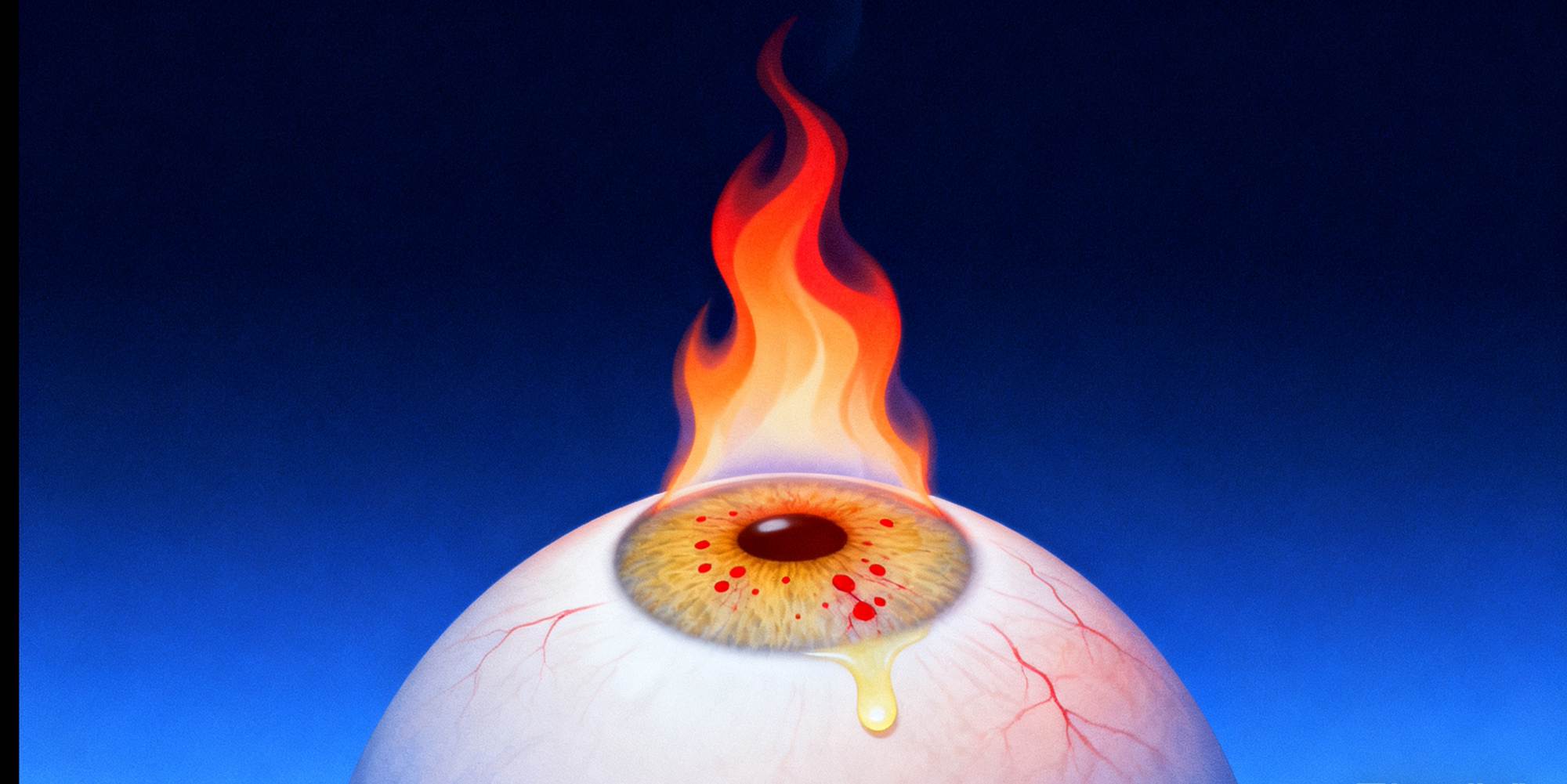 Macular degeneration can be divided into six types and is related to liver, kidney and spleen deficiency