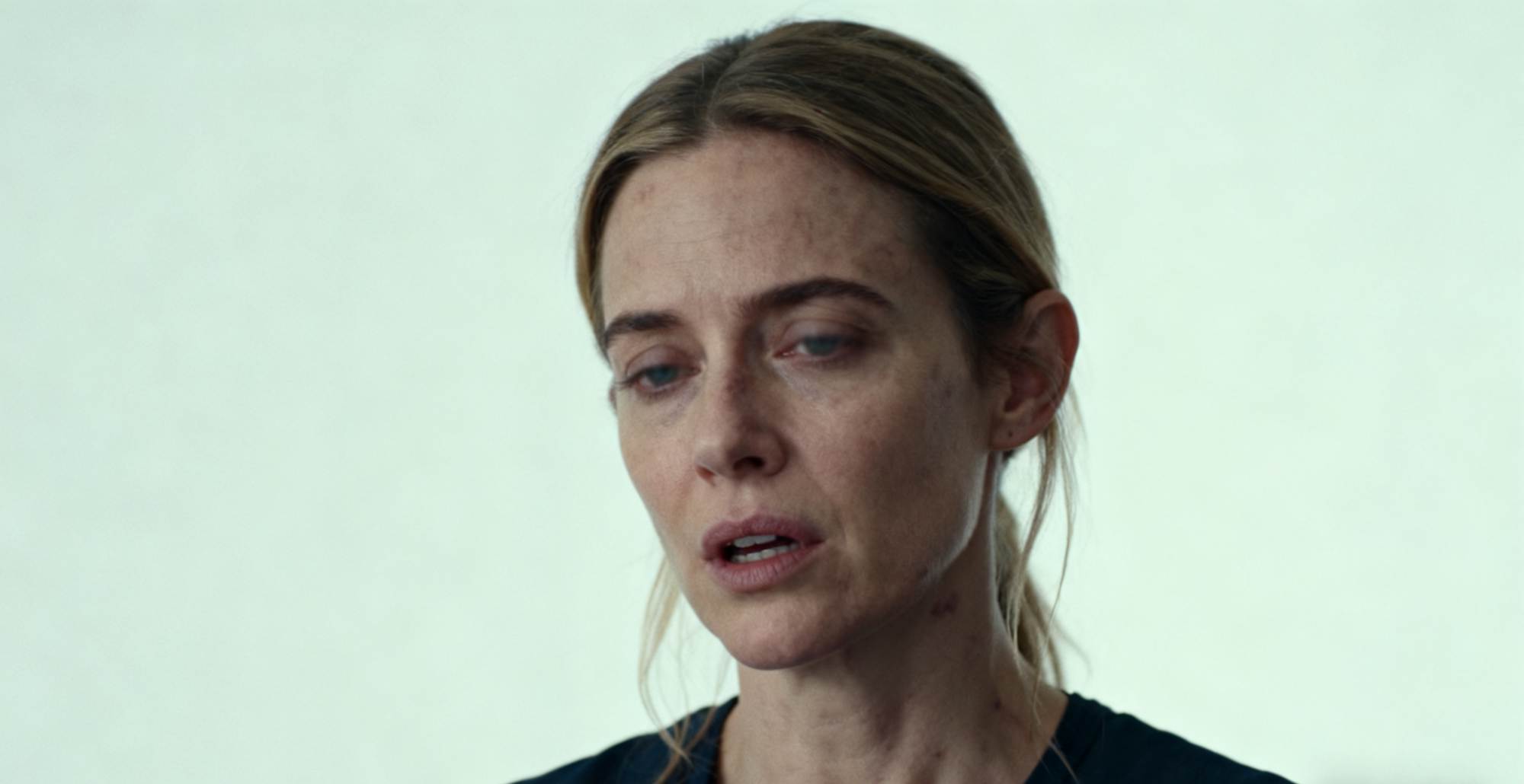 Five Types of People to Be Wary of Blood Clots and Pay Attention to Two Actions